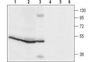 Western blot analysis of rat spleen (lanes 1 and4), rat pancreas (lanes 2 and 5) and mouse B-cell lymphoma (WEHI) (lanes 3 and 6) lysates: - 1-3. (ORAI1 Antikörper  (2nd Extracellular Loop))