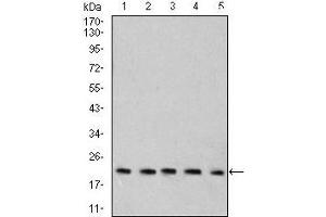 Western blot analysis using Rab6b mouse mAb against C6 (1), SK-N-SH (2), HT-29 (3), PC-12 (4), and C6 (5) cell lysate. (RAB6B Antikörper  (AA 95-208))