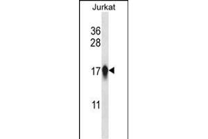 CEN Antibody (Center) (ABIN657764 and ABIN2846742) western blot analysis in Jurkat cell line lysates (35 μg/lane). (CENPA Antikörper  (AA 82-110))