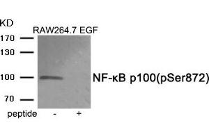 Western blot analysis of extracts from RAW264. (NFKB2 Antikörper  (pSer872))
