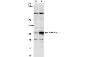 WB Image ATP6V0A2 antibody detects ATP6V0A2 protein by western blot analysis. (ATP6V0A2 Antikörper  (Internal Region))