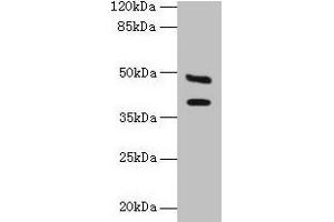Western blot All lanes: CA12 antibody at 6 μg/mL + Mouse kidney tissue Secondary Goat polyclonal to rabbit IgG at 1/10000 dilution Predicted band size: 40, 39 kDa Observed band size: 40, 48 kDa (CA12 Antikörper  (AA 25-301))