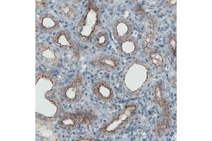 Immunohistochemical staining (Formalin-fixed paraffin-embedded sections) of human kidney with OCLN monoclonal antibody, clone CL1567  shows membranous positivity in renal tubules. (Occludin Antikörper  (AA 282-415))