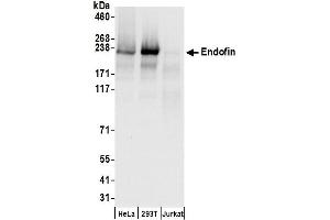 anti-Zinc Finger, FYVE Domain Containing 16 (ZFYVE16) (AA 450-500) antibody
