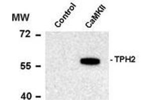 Image no. 1 for anti-Tryptophan Hydroxylase 2 (TPH2) (pSer19) antibody (ABIN372731) (Tryptophan Hydroxylase 2 Antikörper  (pSer19))