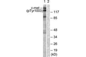 Western blot analysis of extracts from HepG2 cells, using c-Met (Phospho-Tyr1003) Antibody. (c-MET Antikörper  (pTyr1003))