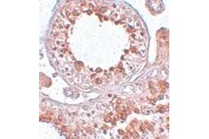 Immunohistochemical staining of human testis tissue with ESX1 polyclonal antibody  at 25 ug/mL dilution. (ESX Homeobox 1 Antikörper)