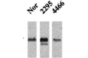 Western Blot analysis of Mouse Ventricle lysates showing detection of CaMKII protein using Mouse Anti-CaMKII Monoclonal Antibody, Clone 22B1 . (CAMKII gamma Antikörper  (Biotin))