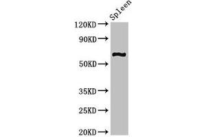 Western Blot Positive WB detected in: Mouse spleen tissue All lanes: CNKSR3 antibody at 2 μg/mL Secondary Goat polyclonal to rabbit IgG at 1/50000 dilution Predicted band size: 62, 101, 93 kDa Observed band size: 62 kDa (CNKSR3 Antikörper  (AA 301-555))