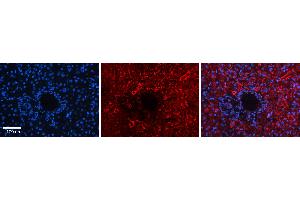 Rabbit Anti-DNAJB12 Antibody   Formalin Fixed Paraffin Embedded Tissue: Human Liver Tissue Observed Staining: Cytoplasm in hepatocytes Primary Antibody Concentration: 1:100 Other Working Concentrations: 1:600 Secondary Antibody: Donkey anti-Rabbit-Cy3 Secondary Antibody Concentration: 1:200 Magnification: 20X Exposure Time: 0. (DNAJB12 Antikörper  (Middle Region))