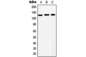Western blot analysis of NCKX1 expression in HeLa (A), SP2/0 (B), NIH3T3 (C) whole cell lysates. (SLC24A1 Antikörper  (Center))