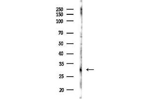 Western blot analysis of lysates from COLO205 cells(UV,30 min treatment), using Carbonic Anhydrase 1/C Antibody at 1/1000 dilution.