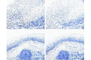 Image no. 2 for anti-Retinoblastoma 1 (RB1) (pSer780) antibody (ABIN967604)