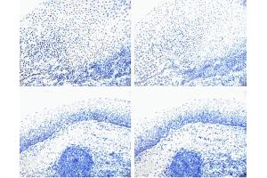 Rb (pS780) staining on tonsil. (Retinoblastoma 1 Antikörper  (pSer780))