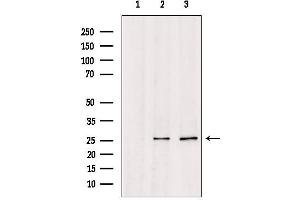Western blot analysis of extracts from various samples, using TSPAN8 Antibody. (Tspan-8 Antikörper  (Internal Region))