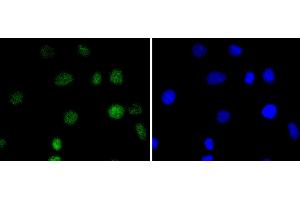 A549 cells were stained with IRF2 (5F2) Monoclonal Antibody  at [1:200] incubated overnight at 4C, followed by secondary antibody incubation, DAPI staining of the nuclei and detection. (IRF2 Antikörper)