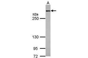 Image no. 1 for anti-Filamin A, alpha (FLNA) (N-Term) antibody (ABIN1494020) (Filamin A Antikörper  (N-Term))