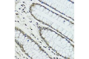 Immunohistochemistry of paraffin-embedded human colon using TRIP12 antibody (ABIN6129753, ABIN6149543, ABIN6149544 and ABIN6225295) at dilution of 1:100 (40x lens). (TRIP12 Antikörper  (AA 1-240))