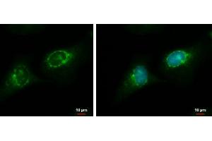 ICC/IF Image RGS7 antibody detects RGS7 protein at endoplasmic reticulum by immunofluorescent analysis. (RGS7 Antikörper)