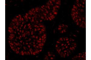 Immunofluorescence (IF) image for anti-RNA polymerase-associated protein RTF1 homolog (RTF1) (C-Term) antibody (ABIN7449019)