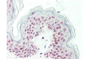 Human Skin: Formalin-Fixed, Paraffin-Embedded (FFPE) (OLIG3 Antikörper  (AA 74-100))