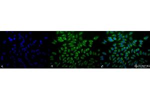 Immunocytochemistry/Immunofluorescence analysis using Mouse Anti-GRP78 Monoclonal Antibody, Clone 1H11-1H7 . (GRP78 Antikörper  (APC))