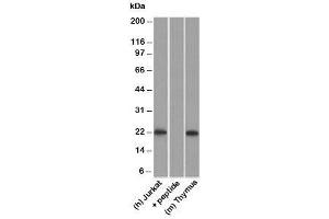 Western blot testing of human Jurkat lysate in the absence and presence of immunizing peptide, and mouse thymus lysate probed with CD3e antibody. (CD3 epsilon Antikörper)