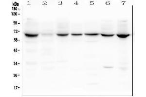 Western blot analysis of LBR using anti-LBR antibody (ABIN6719340). (Lamin B Receptor Antikörper  (AA 102-209))