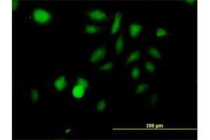 Immunofluorescence of purified MaxPab antibody to STK3 on HeLa cell. (STK3 Antikörper  (AA 1-491))