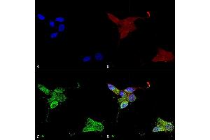 Immunocytochemistry/Immunofluorescence analysis using Mouse Anti-TrpM7 Monoclonal Antibody, Clone S74 (ABIN2483118). (TRPM7 Antikörper  (AA 1817-1863) (PerCP))