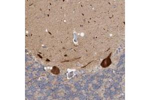 Immunohistochemical staining of human cerebellum with ZNF804B polyclonal antibody  shows strong cytoplasmic positivity in Purkinje cells at 1:200-1:500 dilution. (ZNF804B Antikörper)