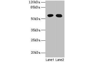 Western blot All lanes: GTPBP6 antibody at 6 μg/mL Lane 1: A549 whole cell lysate Lane 2: Hela whole cell lysate Secondary Goat polyclonal to rabbit IgG at 1/10000 dilution Predicted band size: 57 kDa Observed band size: 57 kDa (GTPBP6 Antikörper  (AA 146-295))