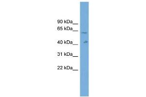 WB Suggested Anti-SLC22A10 Antibody Titration: 0. (SLC22A10 Antikörper  (Middle Region))