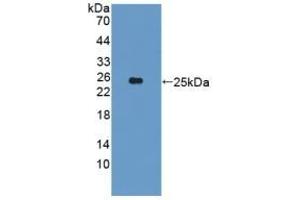 Detection of Recombinant CYP26A1, Human using Polyclonal Antibody to Cytochrome P450 26A1 (CYP26A1) (CYP26A1 Antikörper  (AA 73-255))
