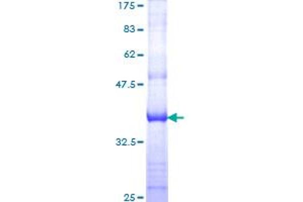CDK5R1 Protein (AA 208-307) (GST tag)