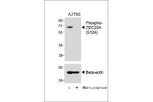 Western blot analysis of lysates from  cell line, untreated or treated with Alkaline phosphatase, 1h, using 459085101 A (upper) or Beta-actin (lower). (CDC25A Antikörper  (pSer124))