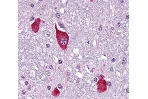 Anti-PTH2R / PTHR2 antibody  ABIN1049269 IHC staining of human brain, neurons and glia. (PTH2R Antikörper  (C-Term))