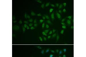 Immunofluorescence analysis of U2OS cells using MYLK3 Polyclonal Antibody (MYLK3 Antikörper)