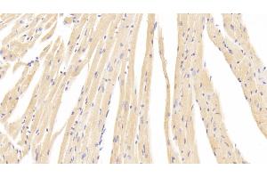 Detection of CACNa1C in Mouse Cardiac Muscle Tissue using Polyclonal Antibody to Calcium Channel, Voltage Dependent, L-Type, Alpha 1C Subunit (CACNa1C) (CACNA1C Antikörper  (AA 1978-2139))