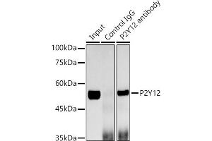 Immunoprecipitation analysis of 600 μg extracts of Mouse brain cells using 3 μg P2Y12 antibody (ABIN7269752). (P2RY12 Antikörper)
