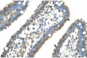 Immunohistochemical staining (Formalin-fixed paraffin-embedded sections) of human intestine with CPS1 polyclonal antibody  at 4-8 ug/mL working concentration. (CPS1 Antikörper  (N-Term))
