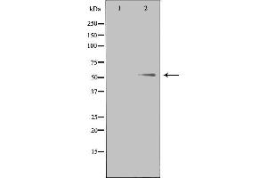 Western blot analysis of extracts from Jurkat cells, using PTHR1 antibody. (PTH1R Antikörper  (pThr1))