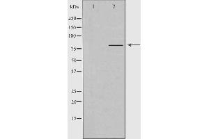 Western blot analysis of extracts from Jurkat cells, using PJA2 antibody. (PJA2 Antikörper)