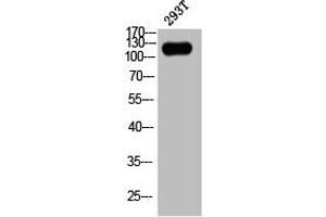 Western Blot analysis of 293T cells using Phospho-p120 (Y228) Polyclonal Antibody (CTNND1 Antikörper  (pTyr228))