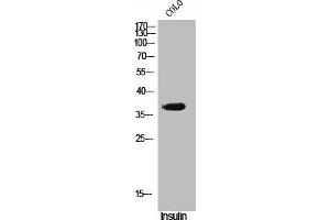 Western Blot analysis of COLO cells using Phospho-VDR (S51) Polyclonal Antibody (Vitamin D Receptor Antikörper  (pSer51))