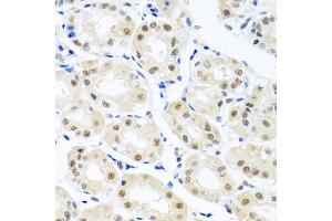 Immunohistochemistry of paraffin-embedded human stomach using THOC1 antibody (ABIN5974800) at dilution of 1/100 (40x lens). (THOC1 Antikörper)