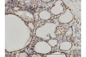 Immunoperoxidase of monoclonal antibody to SFPQ on formalin-fixed paraffin-embedded human thyroid nodular goiter. (SFPQ Antikörper  (AA 269-361))