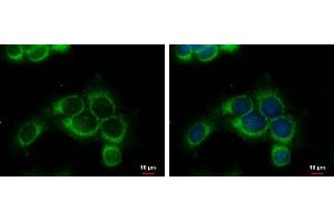 Immunofluorescence (IF) image for anti-Ribonucleotide Reductase M1 (RRM1) (Center) antibody (ABIN2854856)