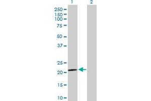 Western Blot analysis of PARK7 expression in transfected 293T cell line by PARK7 MaxPab polyclonal antibody. (PARK7/DJ1 Antikörper  (AA 1-189))