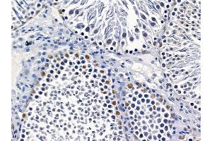hnRNP A1 Mouse Monoclonal Antibody at 1/100 staining rat testis tissue by IHC-P.